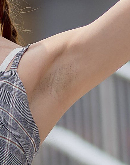 호불호 있는 겨드랑이 상태_4.jpg