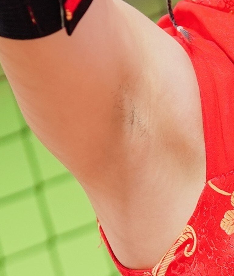 호불호 있는 겨드랑이 상태_7.jpg