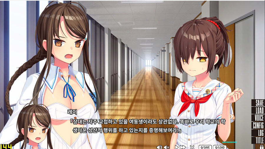누키타시) 머리아프네 시발 ㅋㅋㅋ_1.jpg