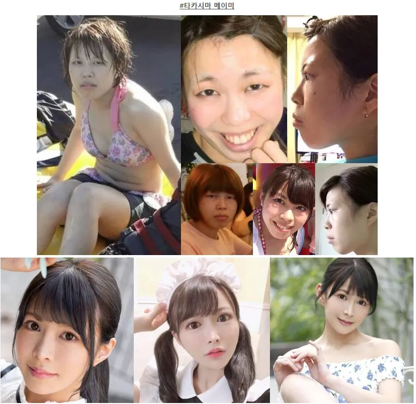 일본도 인정하는 한국의 의술.....jpg_4.webp