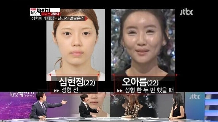10번도 넘게 성형한 여성의 최후_1.jpg