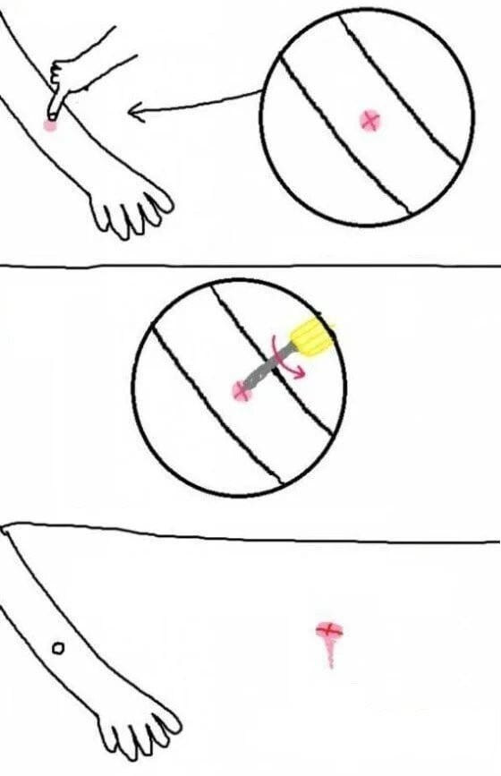 모기 물렸을 때 꿀팁.jpg_1.jpg