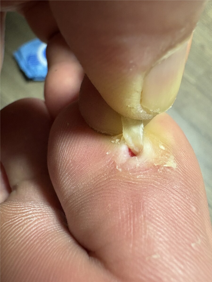 혐) 티눈갤 관우 레전드_2.png