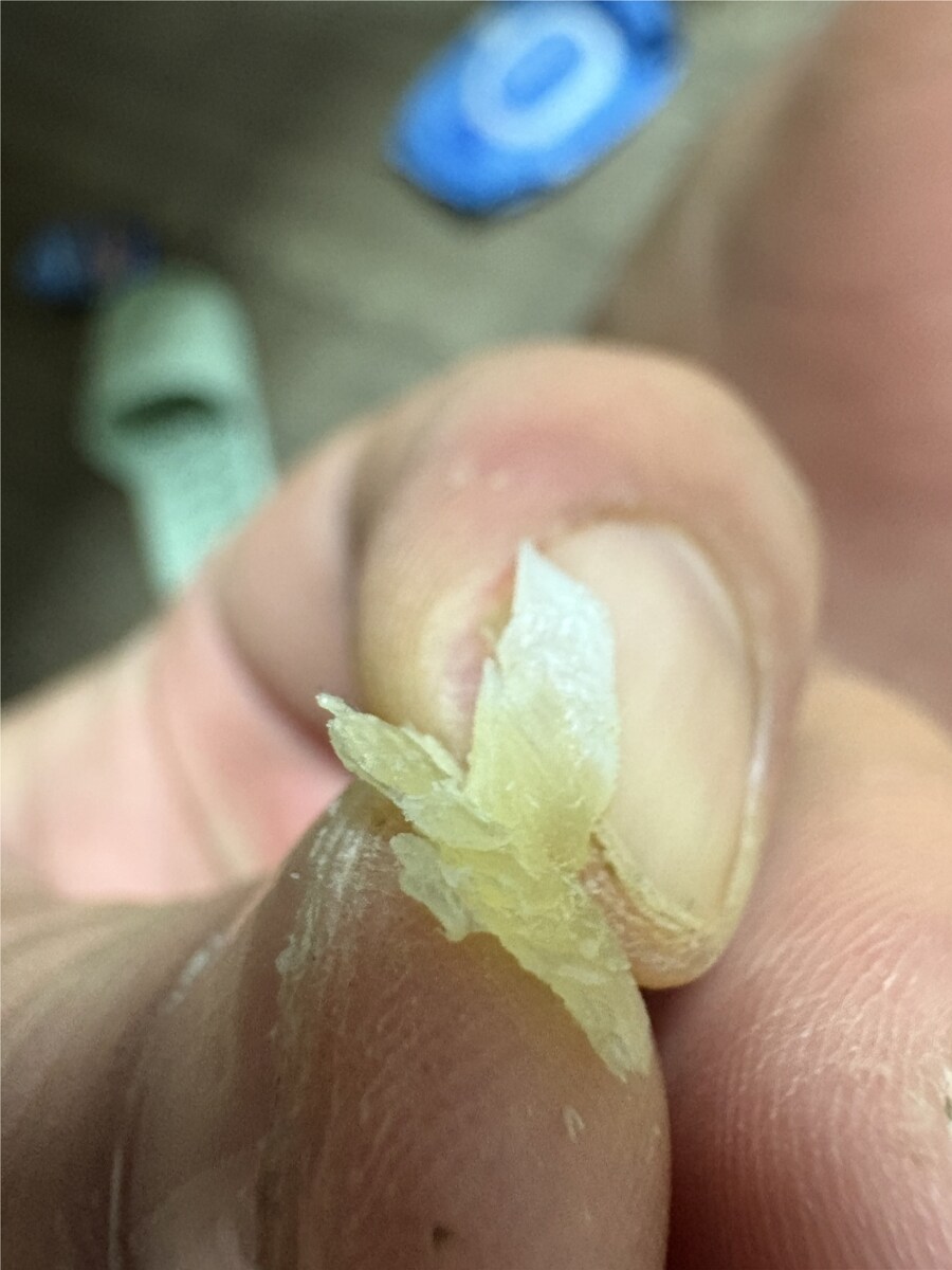 혐) 티눈갤 관우 레전드_3.png