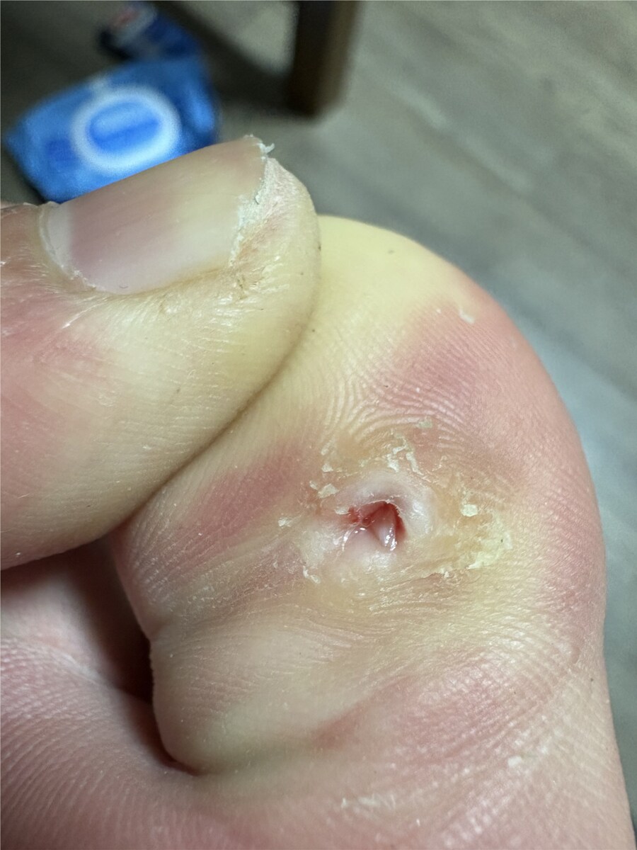 혐) 티눈갤 관우 레전드_4.png