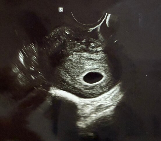 "으럇으럇 팡팡팡" 의 결과_1.png