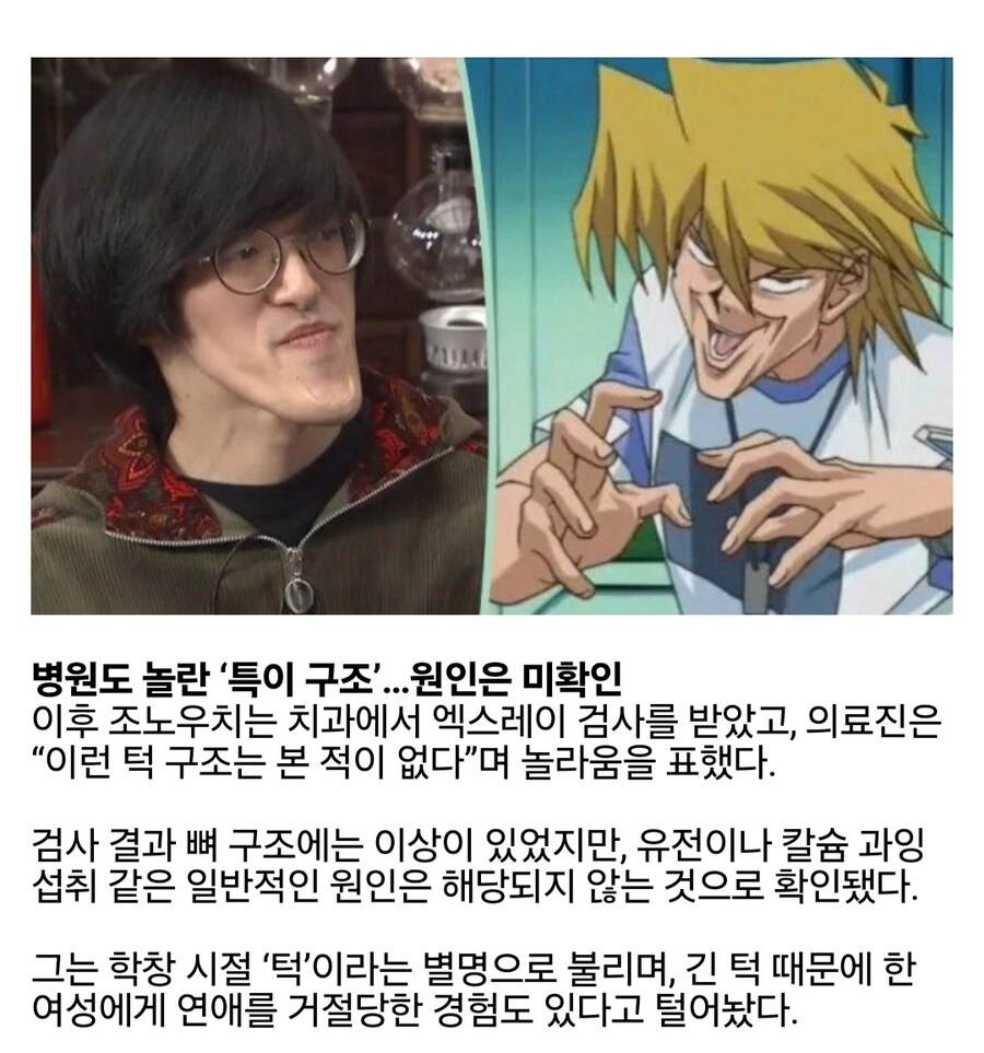우유 마셨는데 턱만 길어진 일본 남성_2.jpg