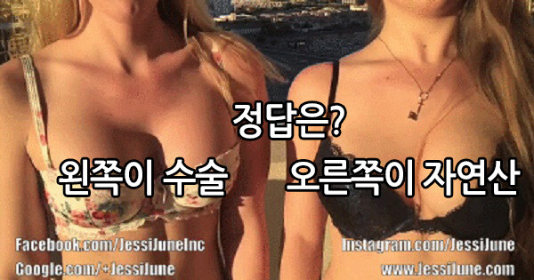 자연산가슴 구분법_1.jpg