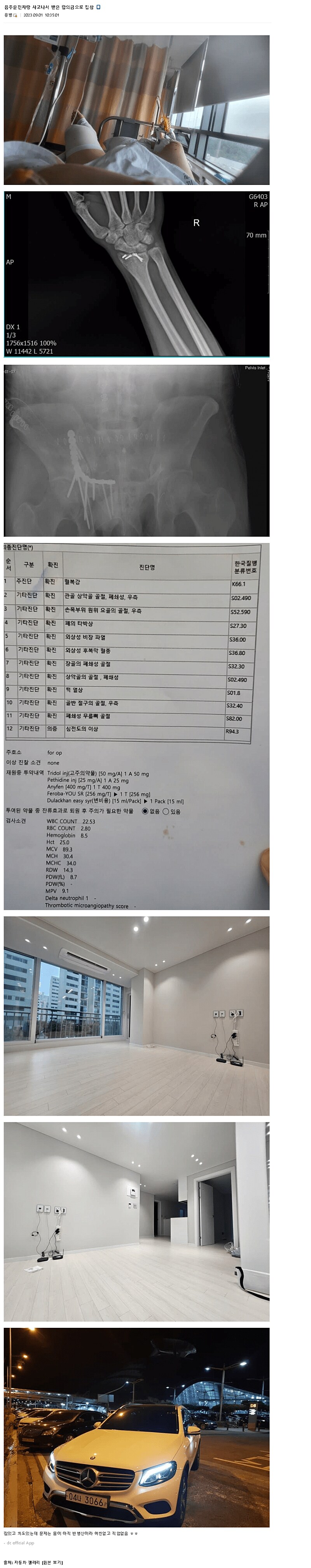 합의금으로 집, 벤츠 구매한 디씨인.jpg_1.png