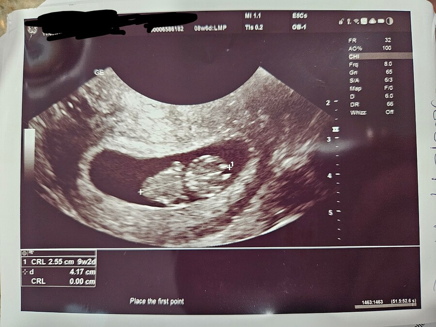 님들 님들 저 특 대박 뉴우스 있음._2.jpg