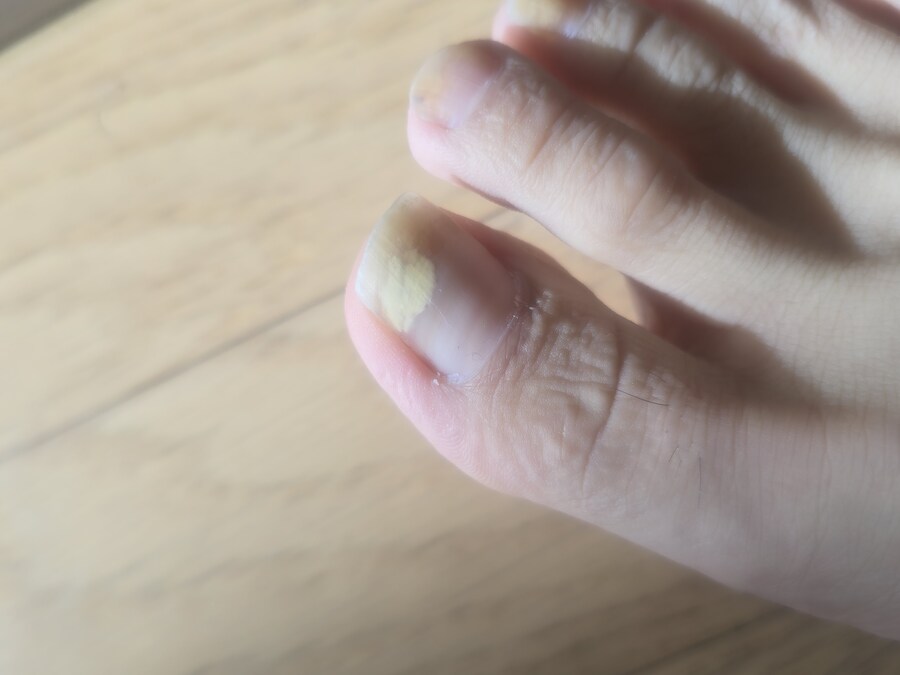 혐) ㅆㅂ 내가 이겼다_1.jpg