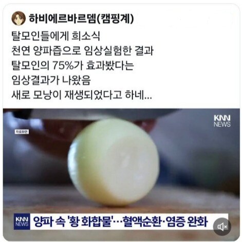 더 이상 희소식을 믿지 않게 된 탈모인들.jpg_1.jpg