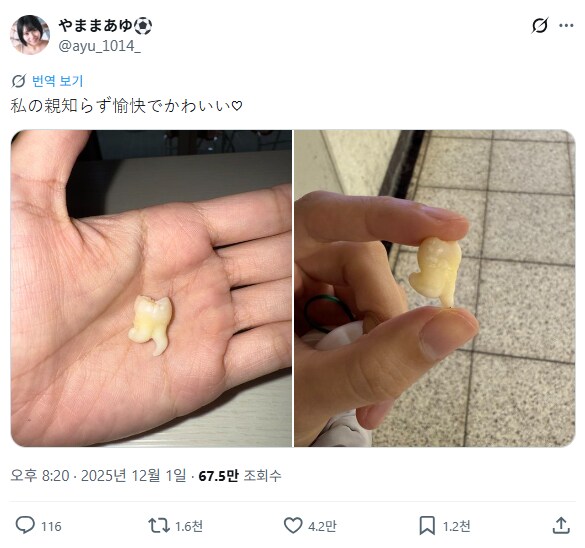 일본에서 화제가 된 어느 모델의 사랑니_1.png