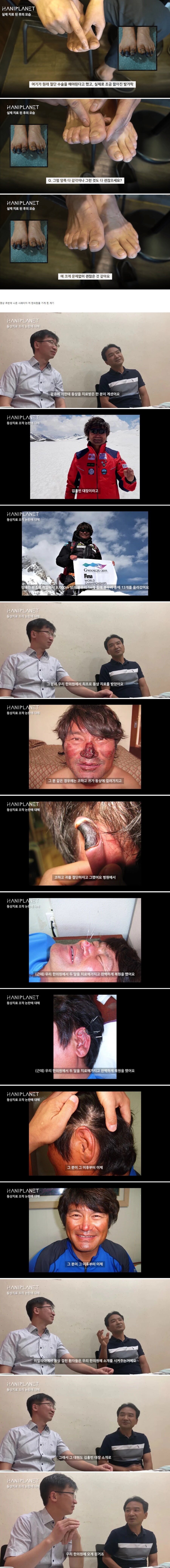 약혐) 플라시보라는 걸로는 설명이 안되는 침술 사례_2.png