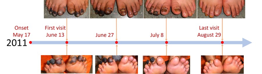 약혐) 플라시보라는 걸로는 설명이 안되는 침술 사례_4.png