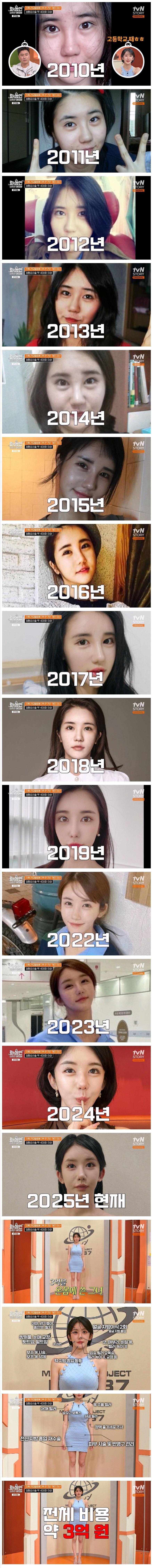 [#화성인이지만괜찮아] 전신 성형에 3억을 사용한 화성인_1.jpg