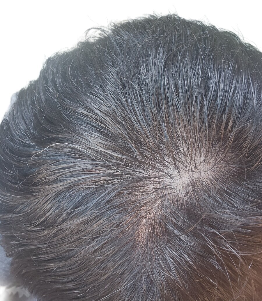 타코야키(진)신약 소식 볼때마다 희망을 가지게 된다_1.jpg