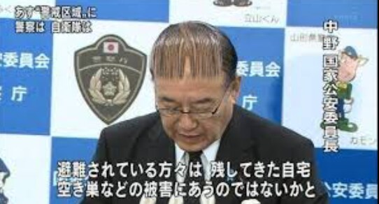 탈모 관련 정리_11.png