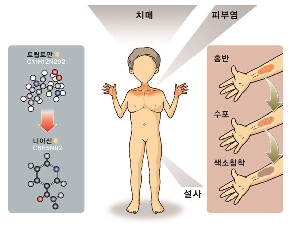 혐주의)조선에서 옥수수가 주식이 될 수 없었던 이유_3.jpg
