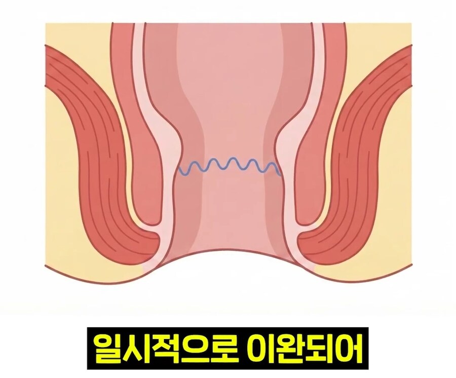 우리 뇌가 방구랑 된장을 구분하는 법_24.jpg