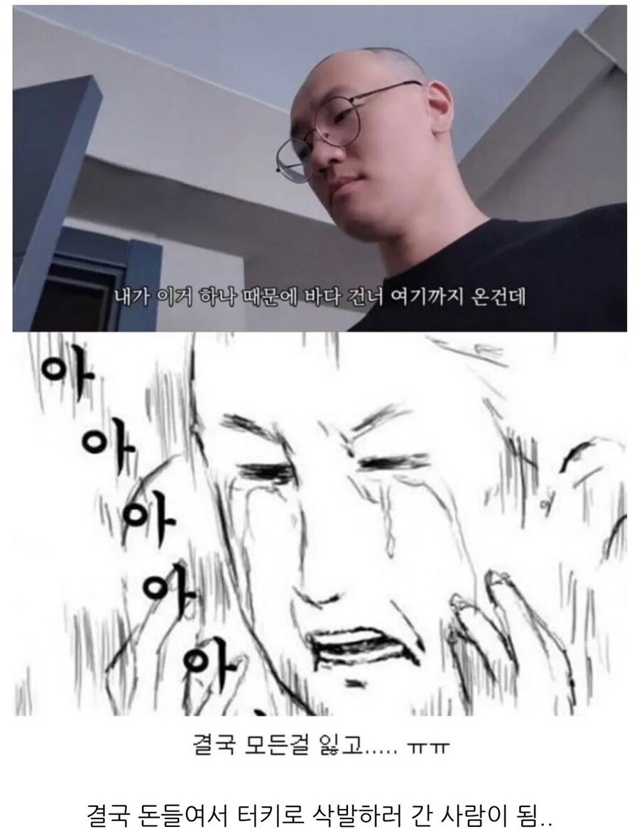 터키로 모발이식 받으러간 남성_3.jpg