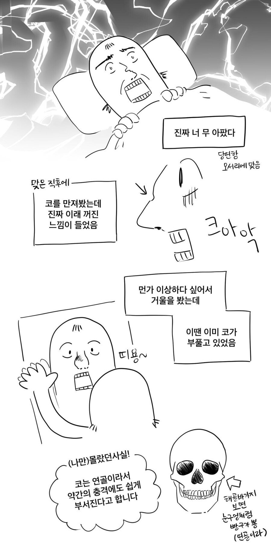 아이패드에 맞아서 코뼈 골절 수술받은 만화_2.jpg