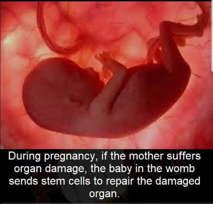 임신중인 산모에게 드물게 일어난다는 현상.jpg_2.webp