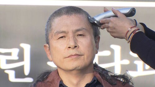 탈모하니 생각나는 사건_1.png