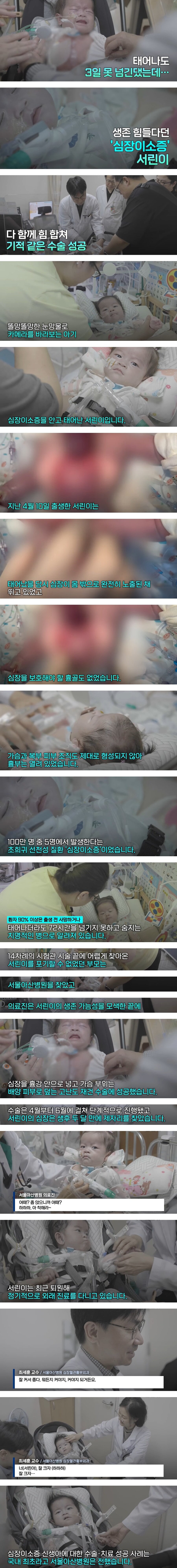 '심장이 몸 밖에 뛰던 신생아' 국내 첫 치료 성공_1.jpg