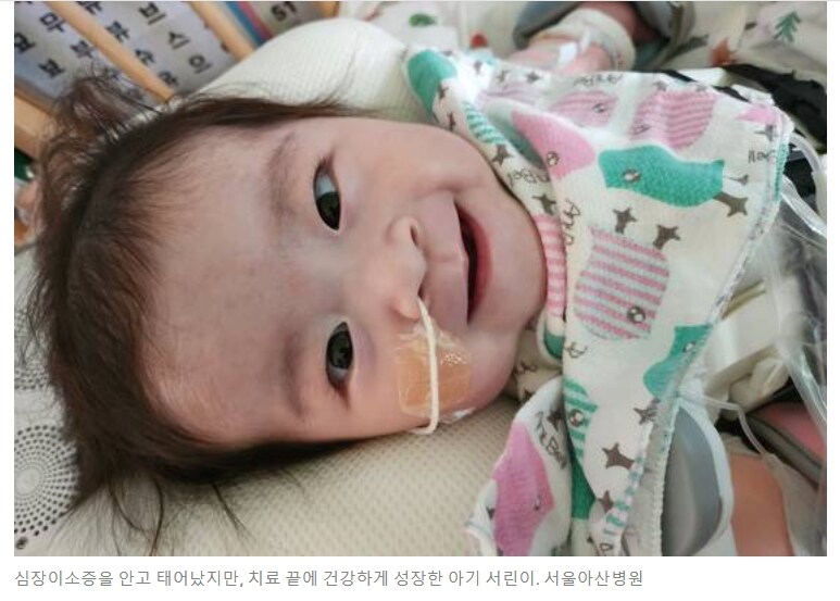 '심장이 몸 밖에 뛰던 신생아' 국내 첫 치료 성공_2.jpg