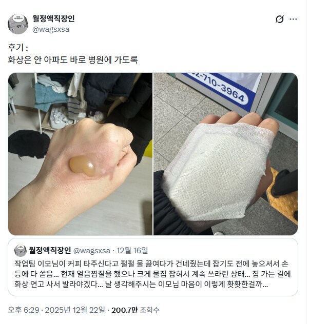 화상은 안아파도 병원에 갈것.jpg_2.png