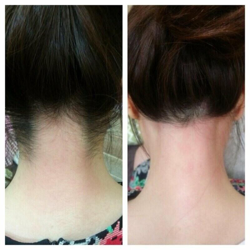 후방 왁싱 처자_1.jpg