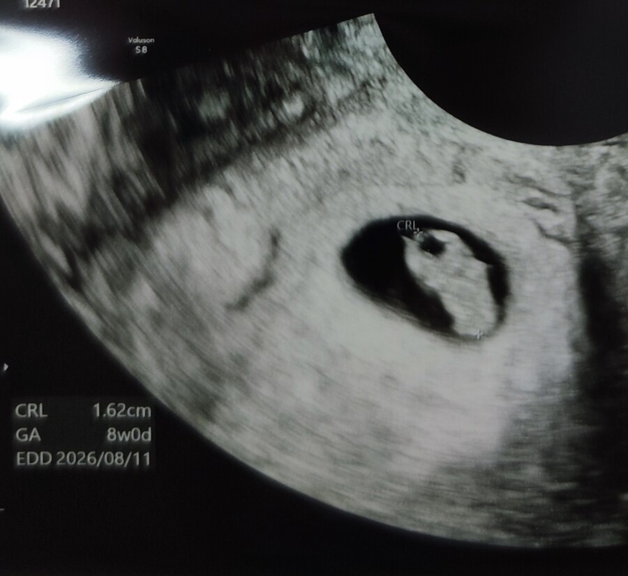 개인적 올해 마지막 희소식_1.jpg