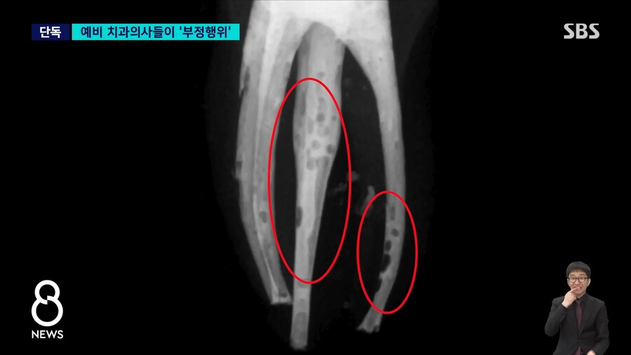 예비 의사들의 놀라운 '포토샵'…"잘 해보려고" 연세대 또 '발칵'_2.png