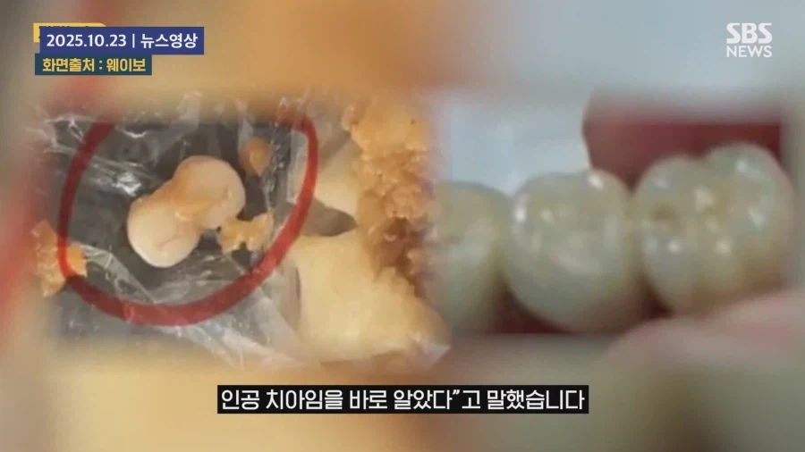 쉽지않은 중국음식의 이물질_18.webp