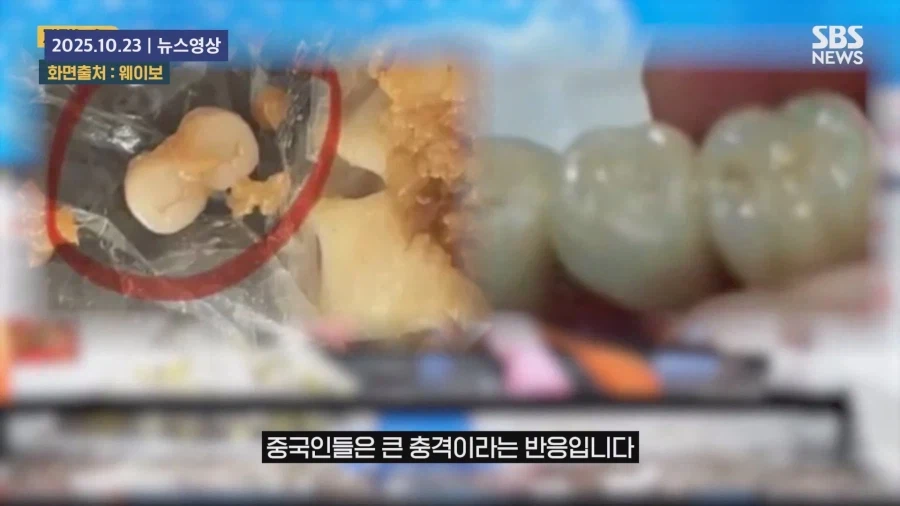 쉽지않은 중국음식의 이물질_20.webp