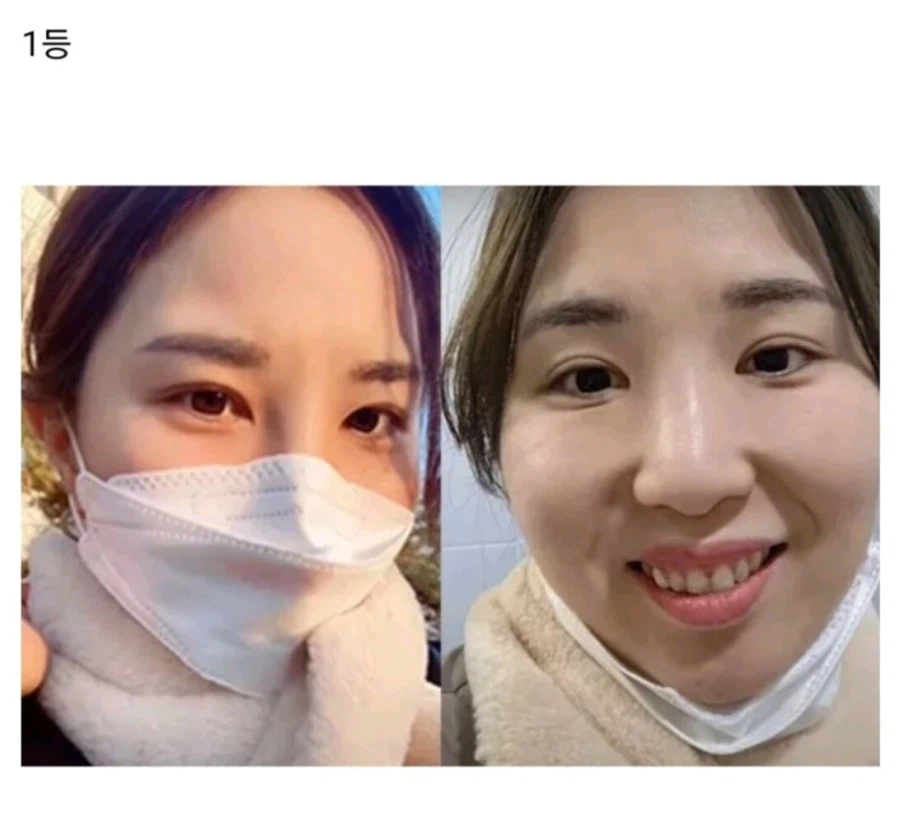 마스크 반전 대회 1등 차지한 여자_2.webp