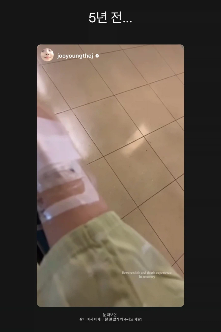 피주의)혐) 코피 때문에 활동중단한 배우 차주영_5.webp