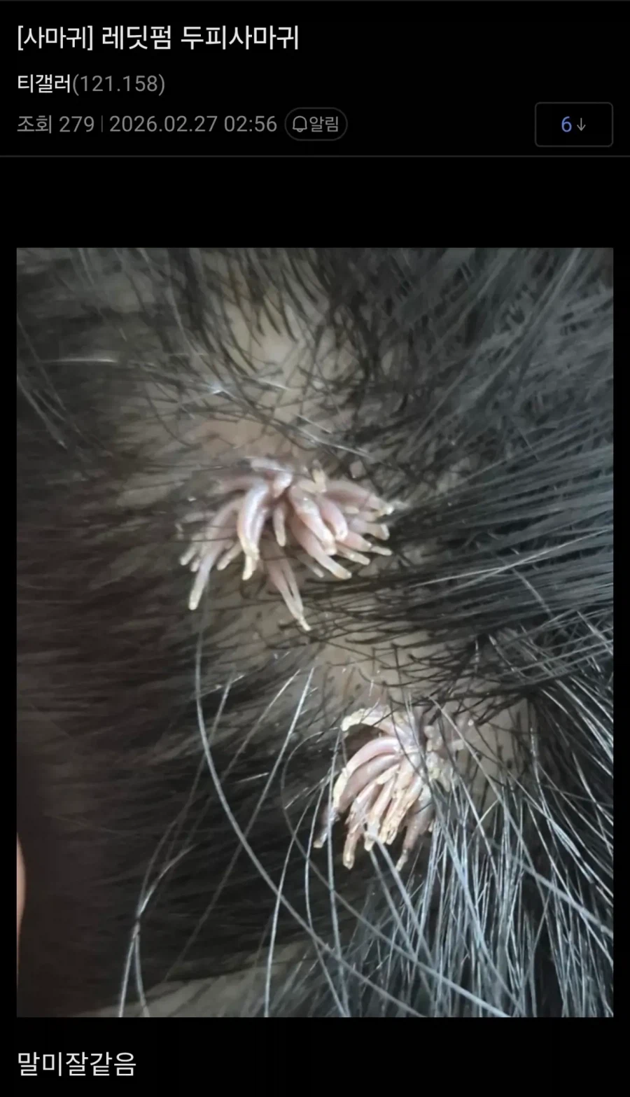 혐) 티눈갤 근황_3.webp