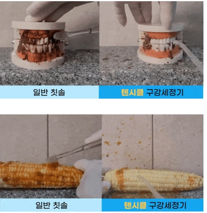 [네이버]이런무선 구강세정기 덤핑 19900원 무배 글 쓰기 전에 잠깐 망설였어요_5.webp