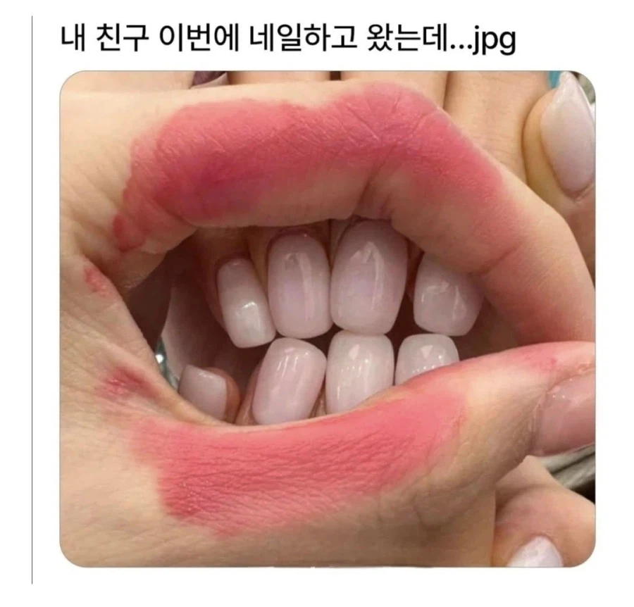 교정이 필요해 보이는 친구의 네일_1.webp