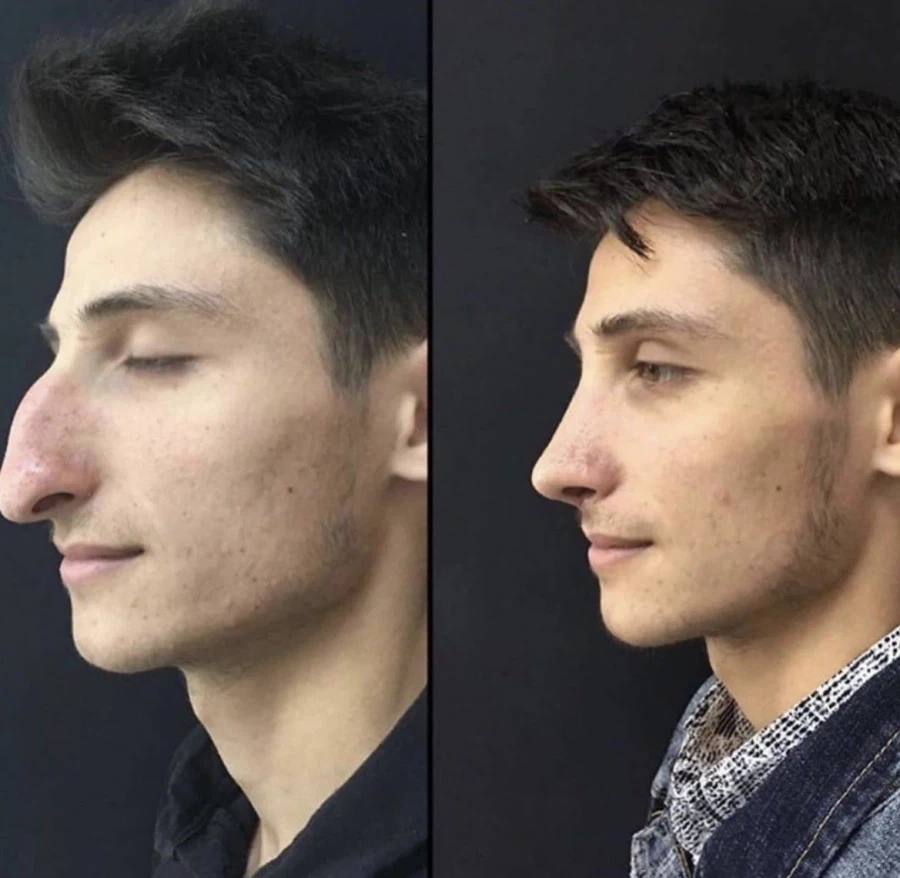 성형수술이 진짜 현대의학의 절정인듯_3.webp