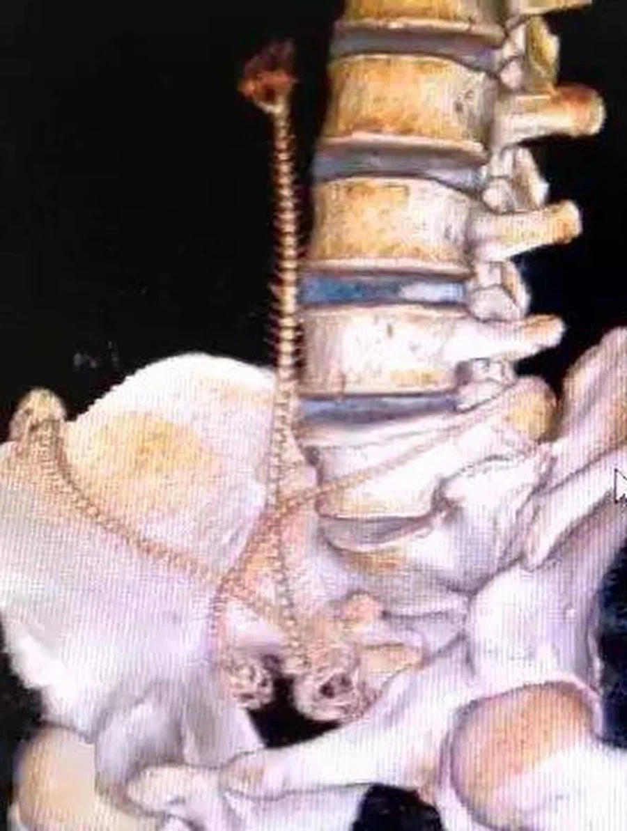 (약혐) 장어와 합체하는 사람들.jpg_5.webp