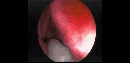 시~원해지는 움짤_1.gif
