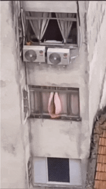 소음순 비대증_2.gif